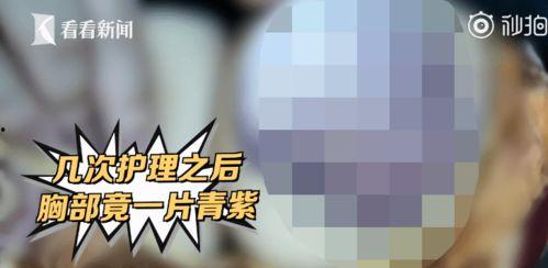 乳房爆料视频,一场关于女性健康的探讨 第3张 乳房爆料视频,一场关于女性健康的探讨 第3张